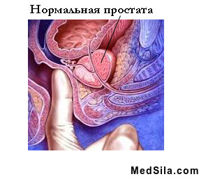 Нормальная простата
